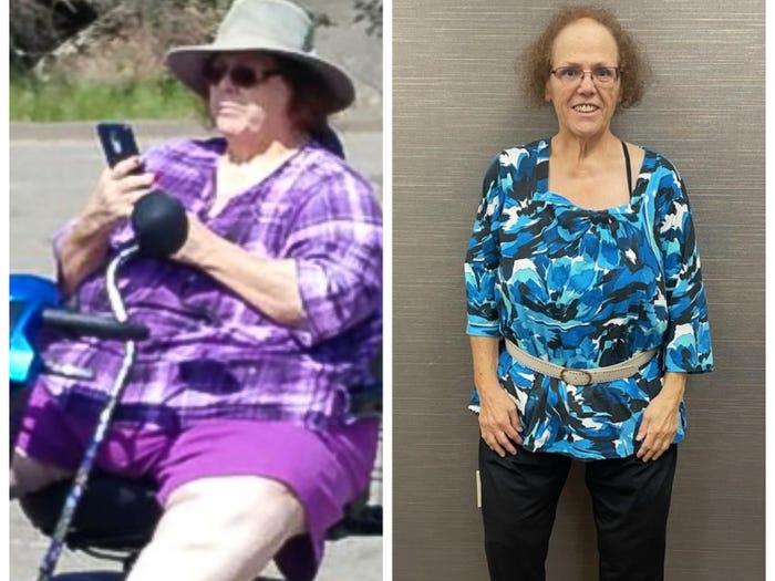 A woman on a mobility scooter before she lost weight next to how she looks now after losing weight.