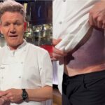Gordon Ramsay shows off a scary bruise on his torso after getting in a ‘really bad’ bike accident: ‘I’m lucky to be alive’